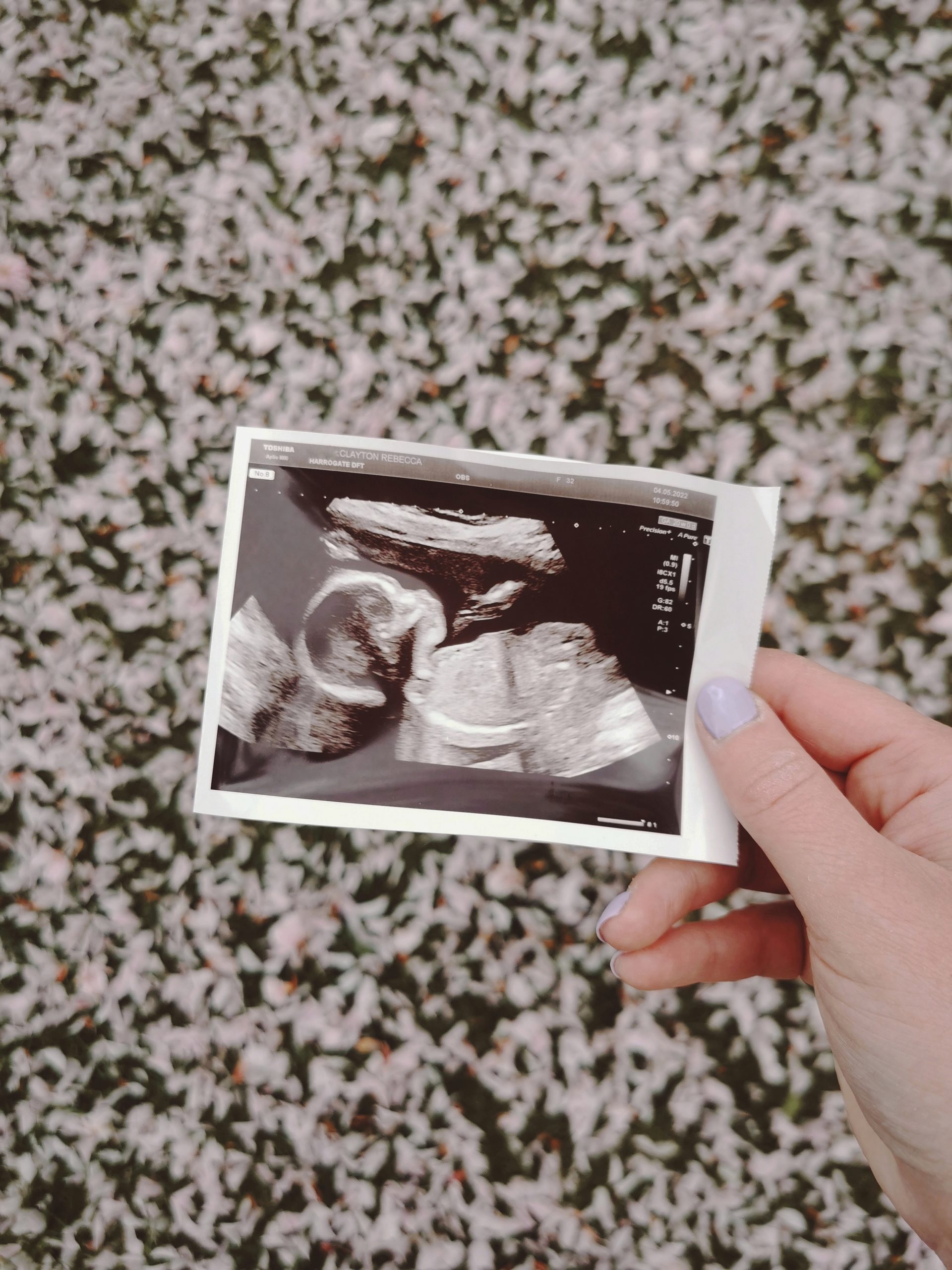 AD Our Pregnancy & Fertility Journey + Giveaway with Zita West